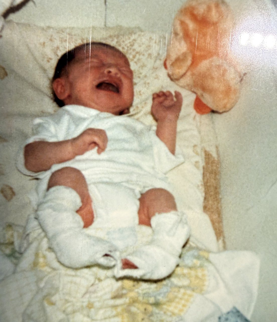 Newborn Heath in a bassinet with casts on both legs, 1985
